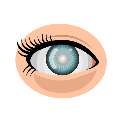 Cataract